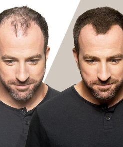 Alternative view of • توبيك هيرفايبر لفراغات الشعر