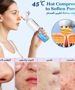 ⁦جهاز إزالة الرؤوس السوداء وشفط المسام مع 3 مستويات من الشفط⁩ - الصورة ⁦3⁩