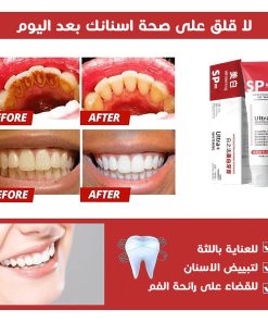 ⁦SP6 - المعجون الأسرع و الأقوى لتبييض الأسنان⁩ - الصورة ⁦3⁩
