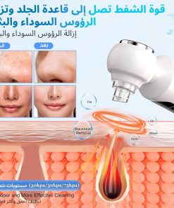 ⁦جهاز إزالة الرؤوس السوداء وشفط المسام مع 3 مستويات من الشفط⁩ - الصورة ⁦4⁩
