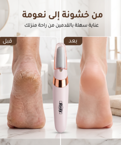 ⁦مقشر القدم الحديث القابل لاعادة الشحن RUAY⁩ - الصورة ⁦3⁩