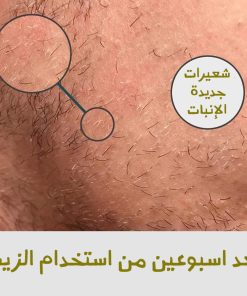⁦زيت تحفيز بصيلات اللحية⁩ - الصورة ⁦3⁩