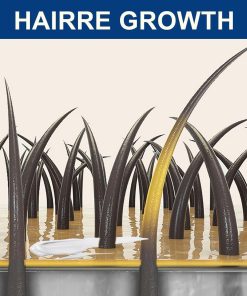 ⁦دهان طبيعي لعلاج داء الثعلبة - 20 جرام⁩ - الصورة ⁦3⁩